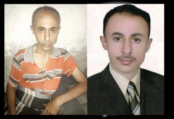 صورتان تلخصان المأساة.. هكذا تعذب المليشيات الصحافيين المختطفين!